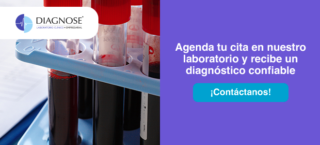 Cuida tu salud sin complicaciones con una prueba de HbA1c. Contáctanos. Cuida tu salud sin complicaciones con una prueba de HbA1c. Contáctanos.