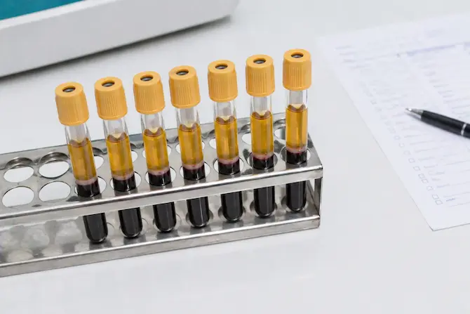 Tubos de muestra con suero sanguíneo separado para procesar química sanguínea de 6, 12 y 24 elementos