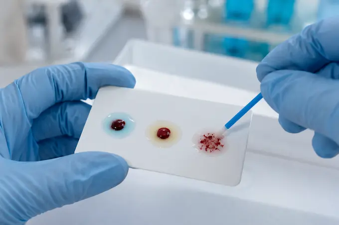 Clasificación de los tipos de sangre